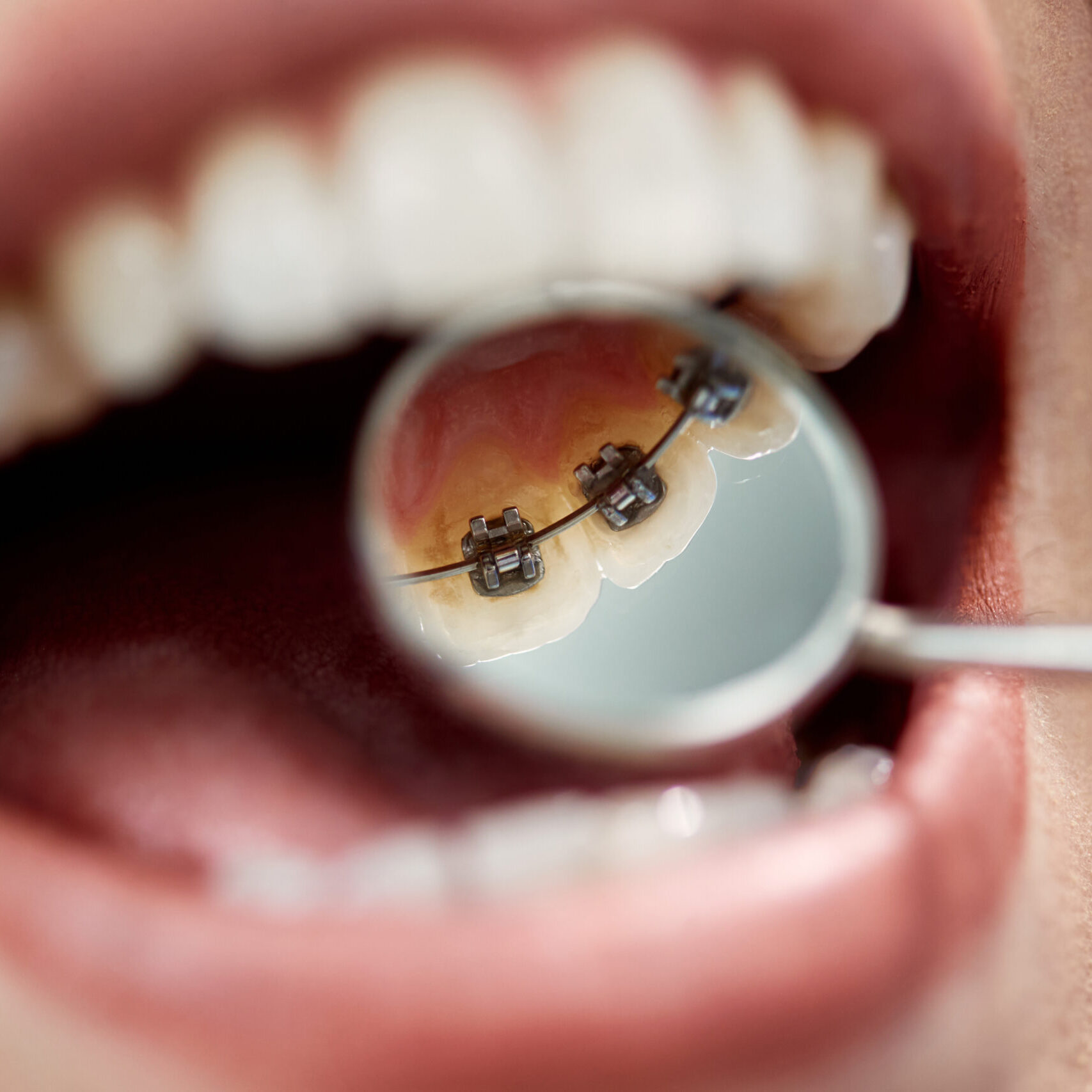 moorestown orthodontist